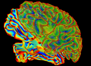 multicolored brain scan image