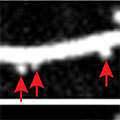 Images of dendritic spine remodeling. Images taken at baseline, after exposure to a stressor (Chronic CORT), and after a single dose of ketamine. Credit: Reprinted with permission from Conor Liston, Science (2019)