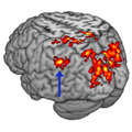 fMRI memory circuits