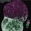 Fused Forebrain Spheroids - assembled forebrain in vitro