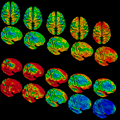 Cortex heritability and variability