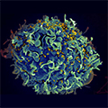 HIV infecting T-Cell