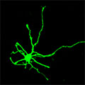 microscopic image of an induced human neuron