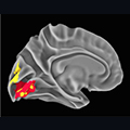 Neanderthal gene-influenced brain visual system areas