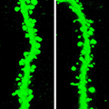 Neuronal spines