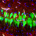 Immunofluorescent stained neurons, astrocytes, and cell nuclei in hippocampal CA3 region of brain