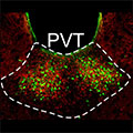 An overlay image of the PVT showing the terminals from the locus coeruleus (red) and the neurons that project to the nucleus accumbens (green).