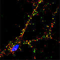 Suspect Gene Corrupts Neural Connections