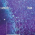 Image showing transplanted human cortical organoids made from cells taken from individuals with Timothy syndrome with immunostaining. Chen et al., Nature.  